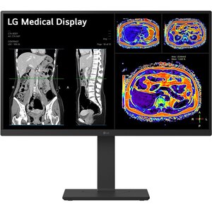 Monitor medical profesional LED IPS LG 27HS713C, 27", 4K 8MP, 60Hz, Brightness Stabilization, negru Monitor medical profesional LED IPS LG 27HS713C, 27", 4K 8MP, 60Hz, Brightness Stabilization, negru