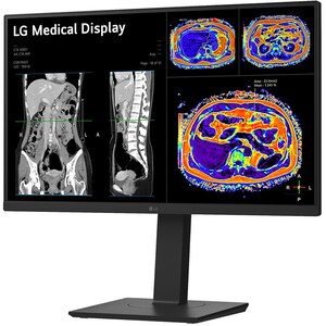 Monitor medical profesional LED IPS LG 27HS713C, 27", 4K 8MP, 60Hz, Brightness Stabilization, negru Monitor medical profesional LED IPS LG 27HS713C, 27", 4K 8MP, 60Hz, Brightness Stabilization, negru