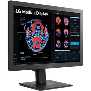 Monitor medical profesional LED IPS LG 24HR513C-B, 24", Full HD, 60Hz, Brightness Stabilization, negru Monitor medical profesional LED IPS LG 24HR513C-B, 24", Full HD, 60Hz, Brightness Stabilization, negru